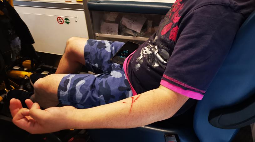 遇襲的攝影記者手臂被抓傷。WeChat圖片