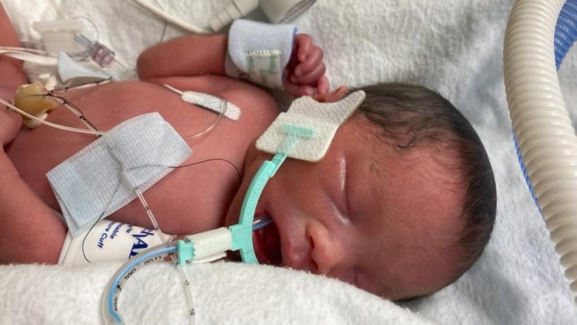 女婴上周六在二埠的皇家哥伦比亚医院出生，体重3磅零半安士。 CTV