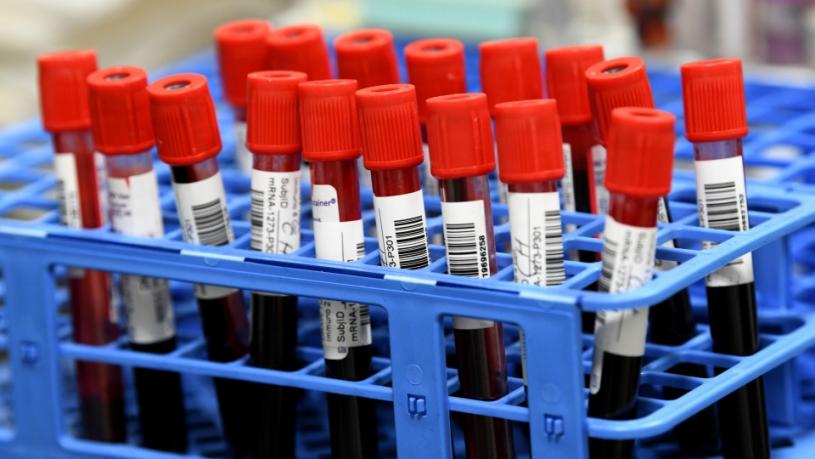 安省一间医疗保健公司，研发了只须使用血液样本，就可同时筛查多种癌症的方法。CTV