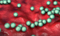 兒童高危！加拿大侵襲性A型鏈球菌病例飆升