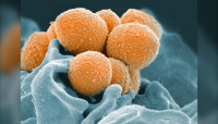 卑詩報告第4宗10歲以下童死於侵襲性鏈球菌感染