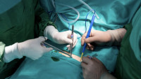 日本醫生認錯血管切斷2條動脈　病人「大出血」休克死亡