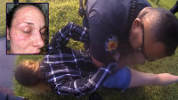美國女子遭警察被壓草地   臉部遭紅火蟻咬傷致毀容