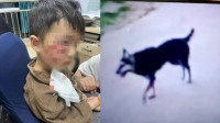 河南3岁童被哈士奇咬伤苦撑18日后离世　至今未找到肇事狗主