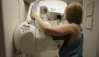 專家呼籲降低女性乳房篩查年齡  聯邦政府堅拒