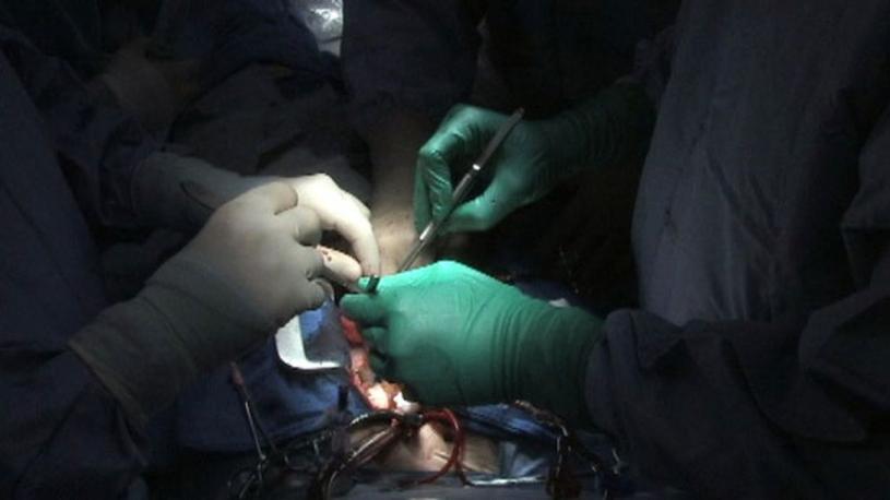 新冠患者占用大量医疗资源，卑诗省100个心内手术被迫推迟。  星报图片