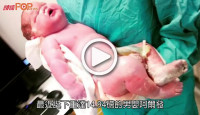 (視頻)巨嬰誕生｜英婦誕14.94磅巨嬰醫生料愛食甜品有關