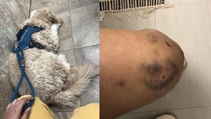 受惊的小狗米洛(左)和主人帕内奇膝盖上的伤痕(右)。 Rajleen Panaych摄