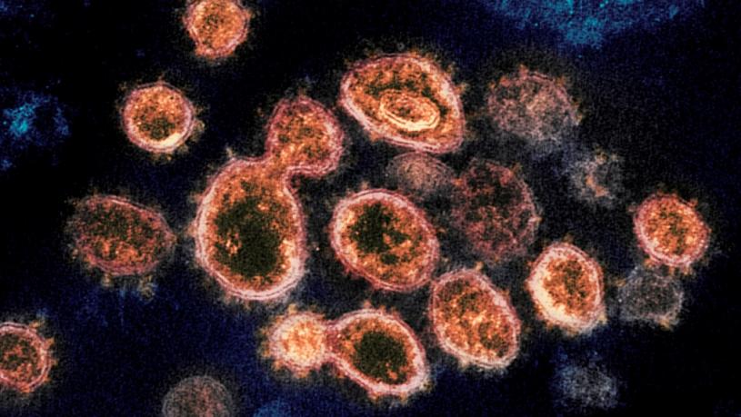 UBC一个研究团体发现数种新的冠状病毒。CTV资料图片