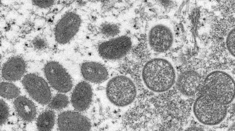 卑诗省确认两宗猴痘病例。  美联社