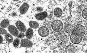 加拿大政府因猴痘病毒發旅行警告。美聯社