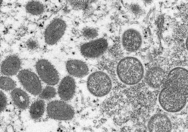 在這張由疾病控制及預防中心提供的2003年電子顯微鏡圖像，顯示成熟的橢圓形猴痘病毒粒子（左側）和球形未成熟病毒粒子（右側）。美聯社