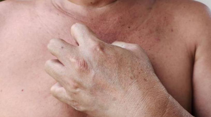 Portrait showing skin damage, acne and blemishes, dermatitis inflammation on the body, problem wrinkle and dark spots of the man, concept health care.