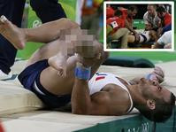 【里約奧運】法國選手跳馬失手左小腿骨折