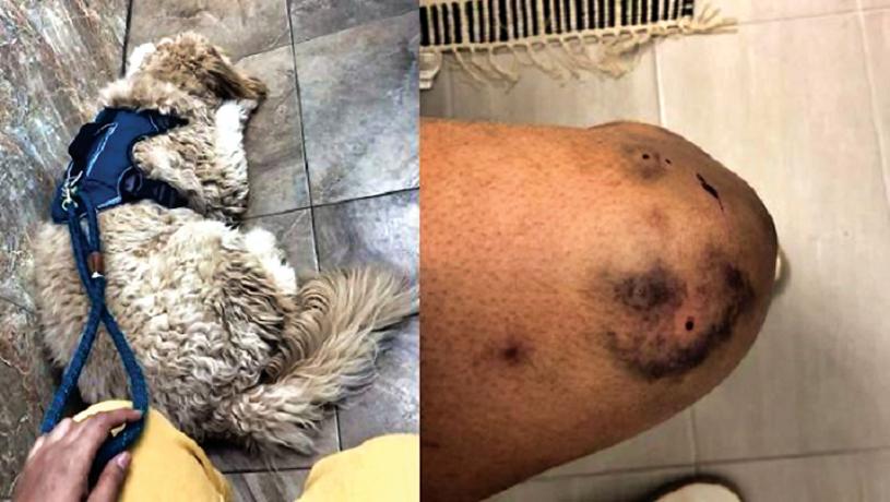 ■受驚的小狗米洛(左)和主人帕內奇膝蓋上的傷痕(右)。 Rajleen Panaych攝
