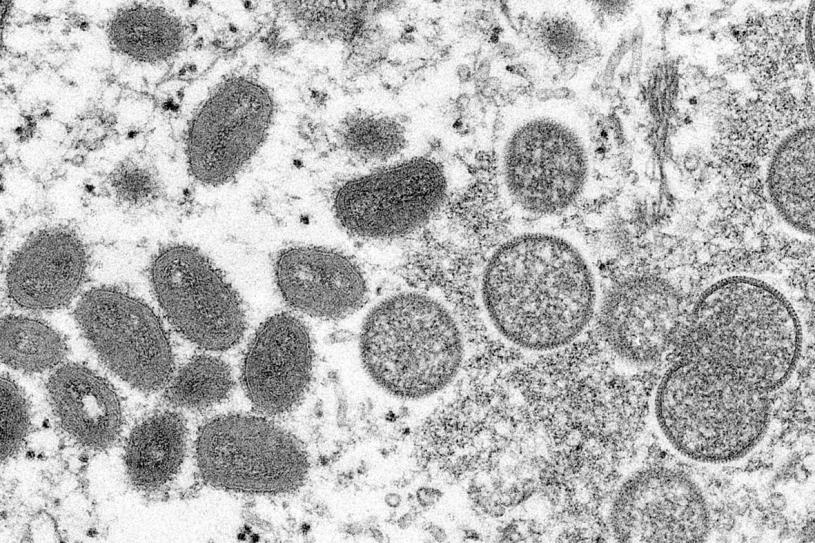 ■圖為電子顯微鏡圖像下成熟的猴痘病毒(左)和未成熟病毒粒子(右）。美聯社資料圖片
