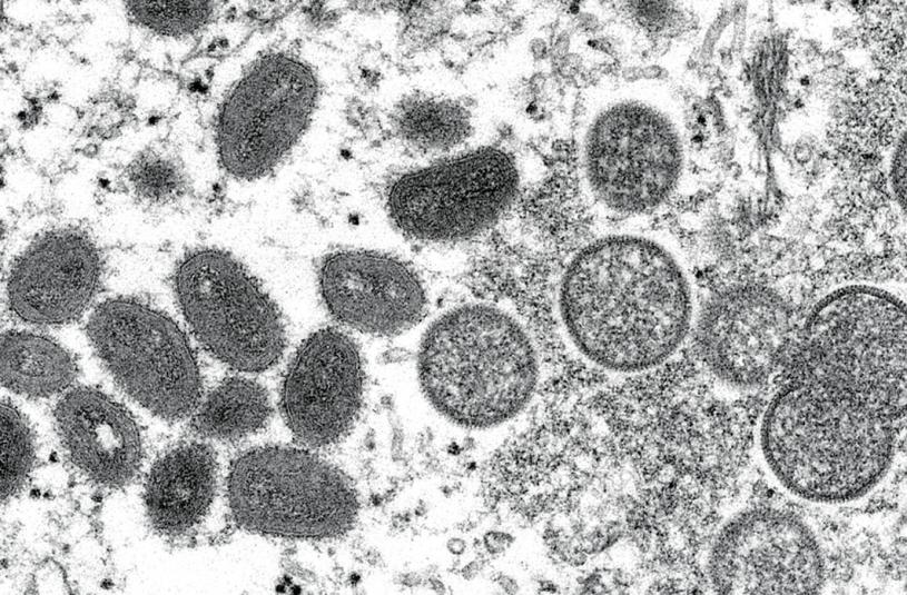 ■加拿大共報告了278例猴痘確診病例。美聯社資料圖片