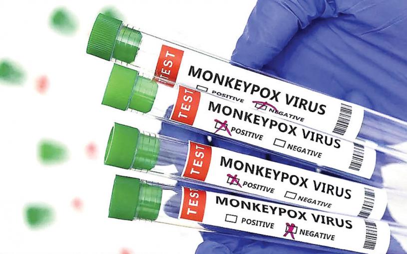 ■安省猴痘確診病例由本月初的18宗增至目前33宗。路透社資料圖片