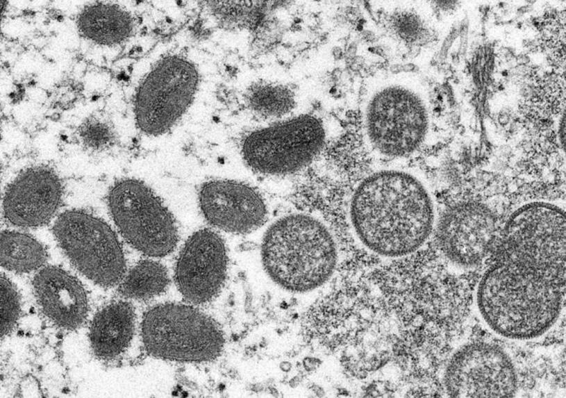 ■在这张由疾病控制及预防中心提供的2003年电子显微镜图像，显示成熟的椭圆形猴痘病毒粒子（左侧）和球形未成熟病毒粒子（右侧）。美联社