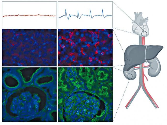 （上至下）左邊為死豬的心電圖、肝細胞、腎臟細胞影像；右邊為使用了OrganEx技術的影像。