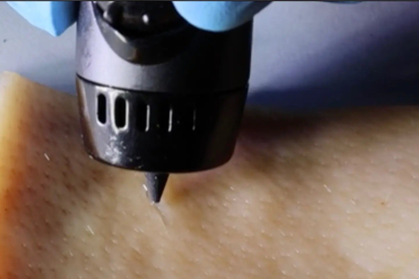 科技生活| 高科技医疗3D打印笔  愈合凝胶涂伤口效果佳