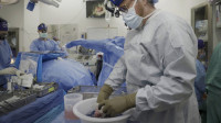 猪肾移植脑死病人成功运作月余 跨物种器官移植大突破