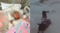 哈尔滨10岁男童遭两恶犬咬成重伤  已脱离生命危险但很大机会要截肢