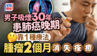 肺癌治療｜男子吸煙30年 咳嗽求醫已肺癌晚期 靠1種療法腫瘤消失 附成因症狀